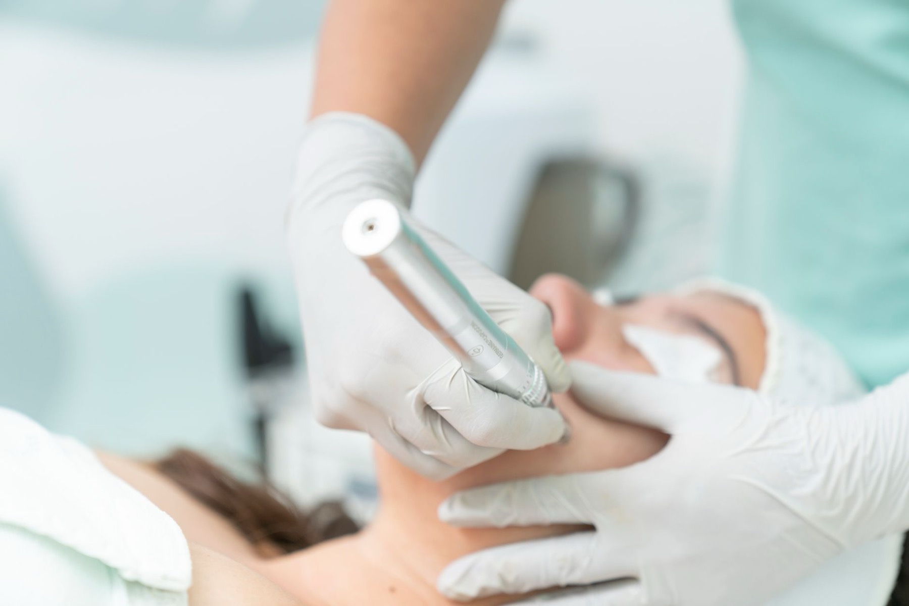 Microneedling in Mönchengladbach – Bellas Madero