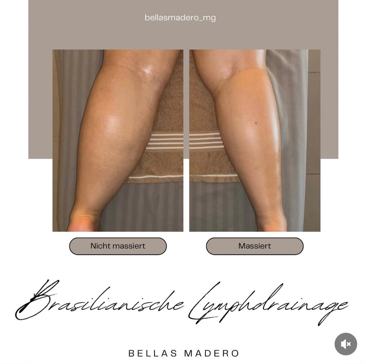 Brasilianische Lymphdrainage